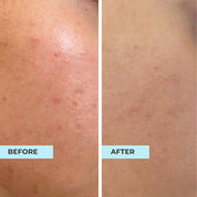 Sensitive & Redness Oligopeptide Complex Serum