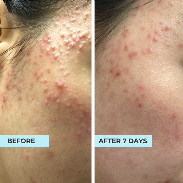 Customer result photo