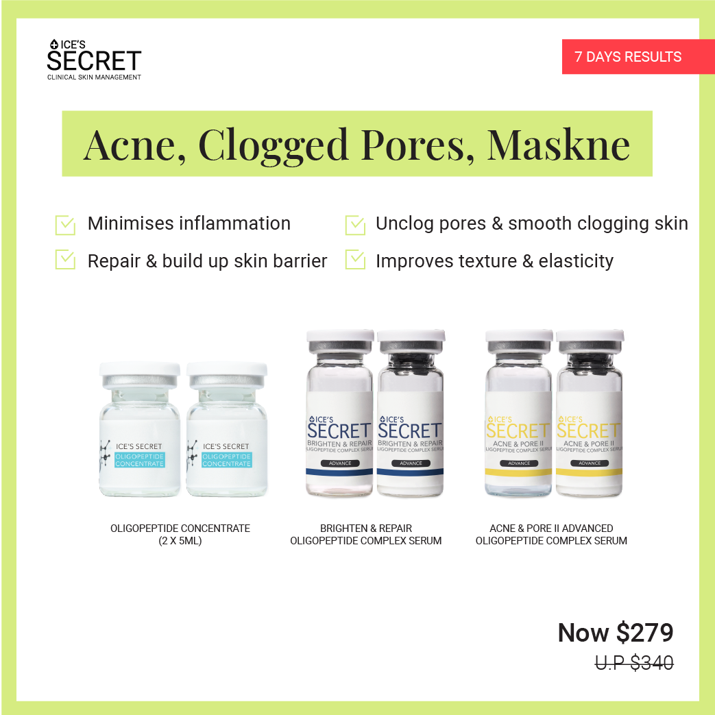 Acne, Clogged Pores, Mask Acne Serum Kit