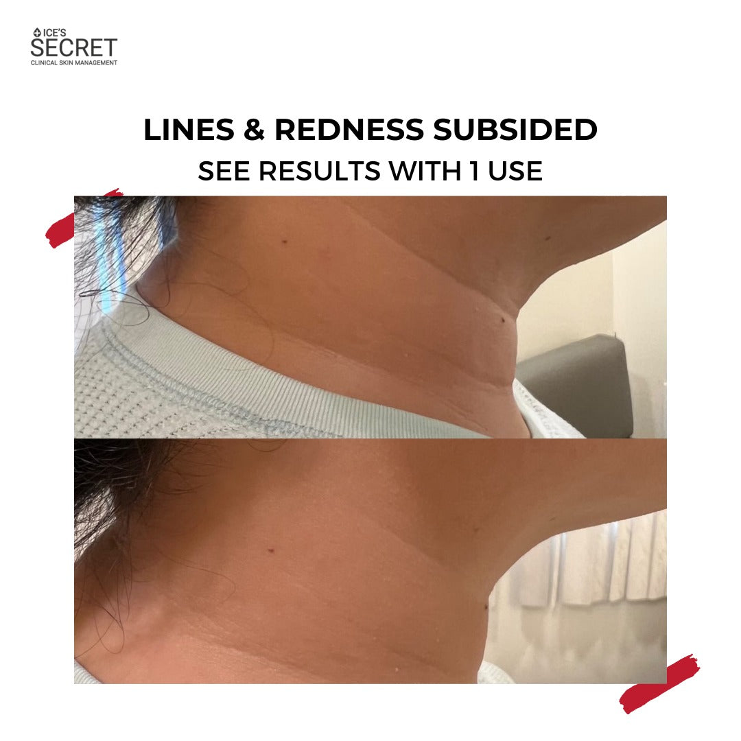 XL Youth Filler Face & Neck Mask