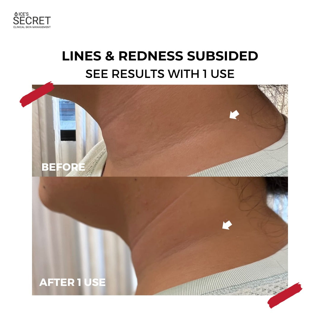 XL Youth Filler Face & Neck Mask