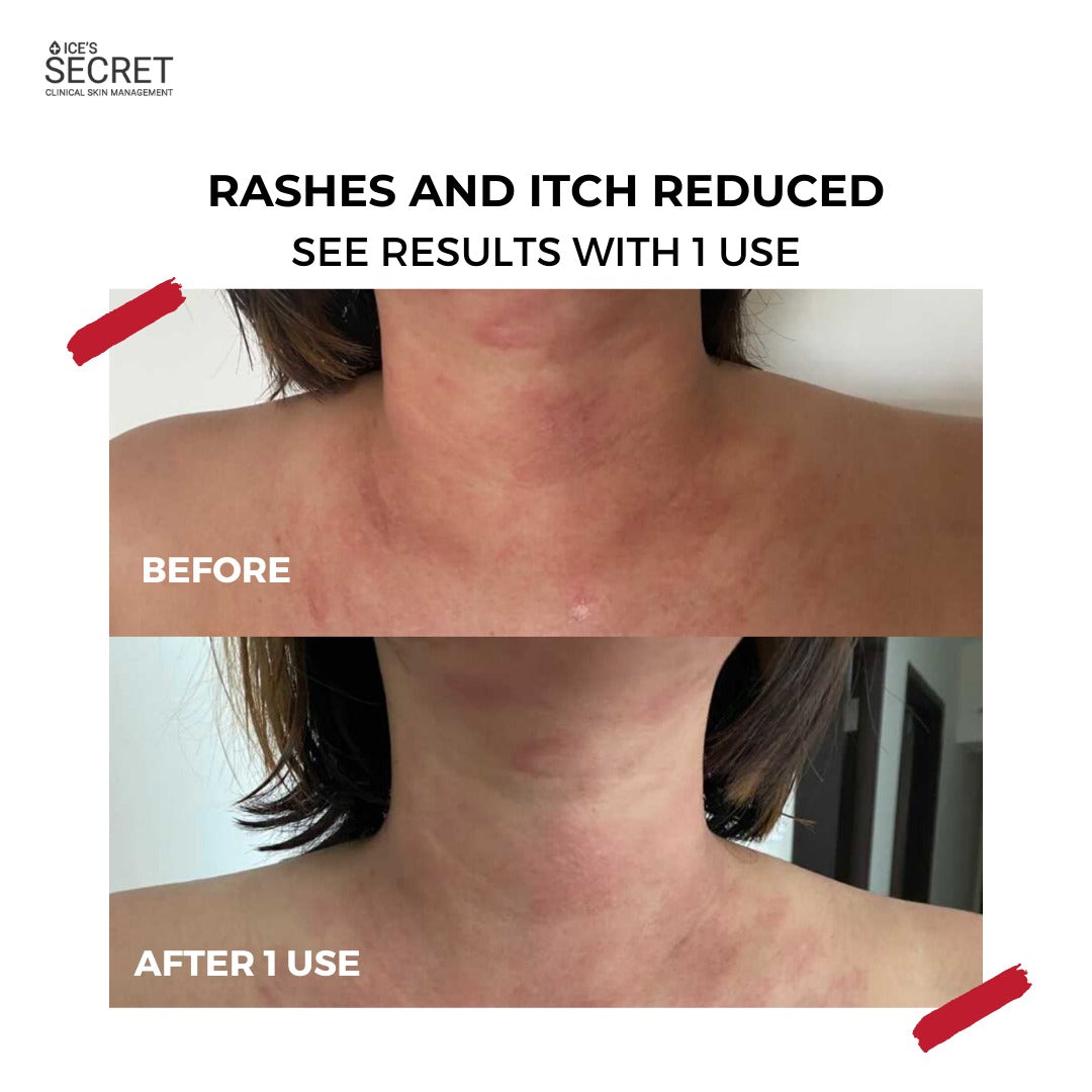 XL Youth Filler Face & Neck Mask