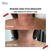 XL Youth Filler Face & Neck Mask