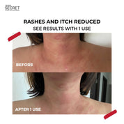 [12.12 Specials] XL Youth Filler Face & Neck Mask