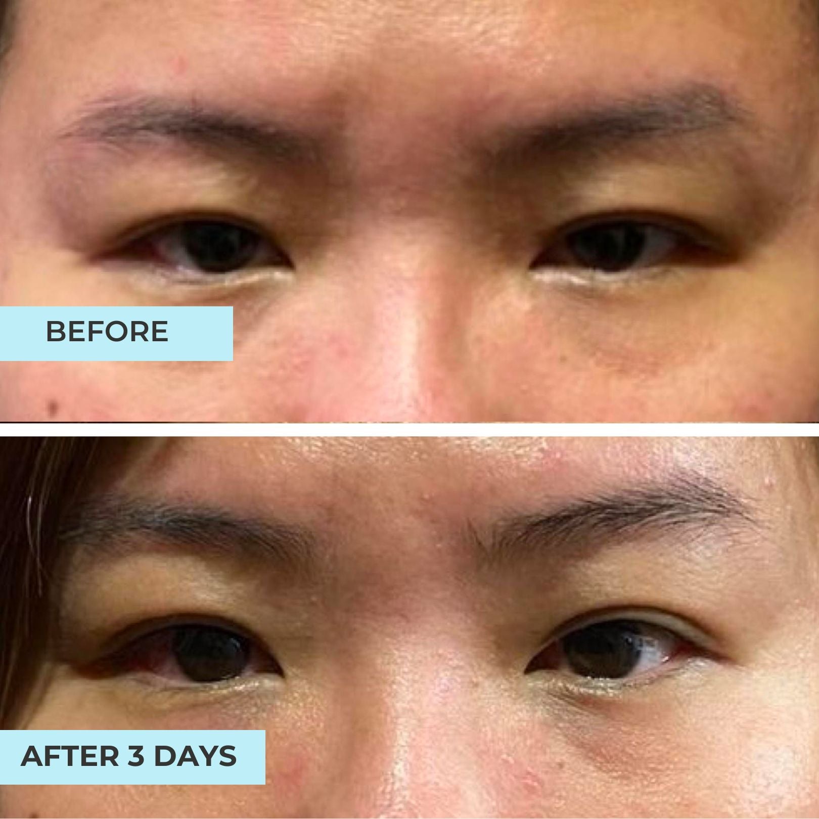 Youth Filler Eye Concentrate