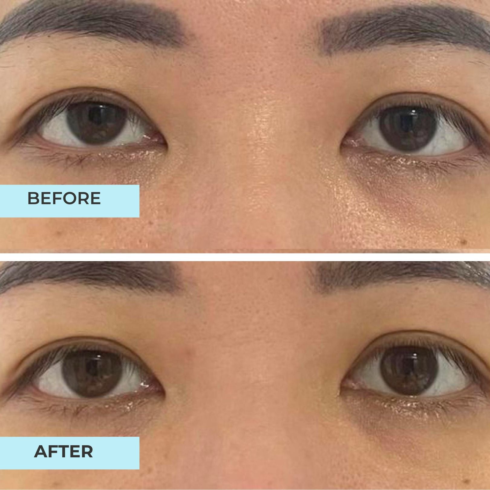 Youth Filler Eye Concentrate