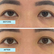 Youth Filler Eye Concentrate