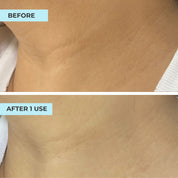 Youth Filler Neck Mask