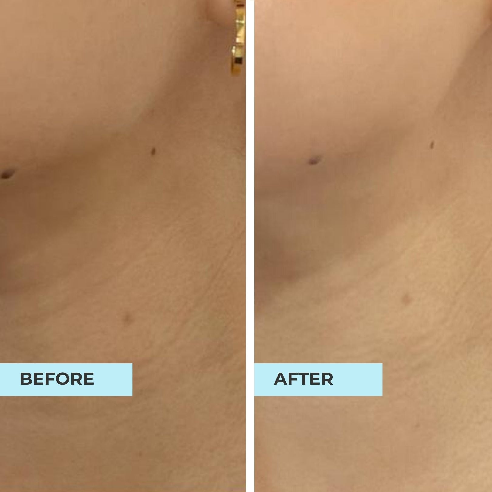 Lift & Bouncy Skin Kit