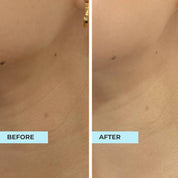 Lift & Bouncy Skin Kit