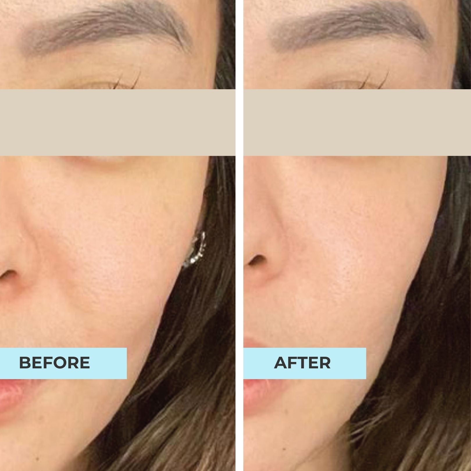 Lift & Bouncy Skin Kit
