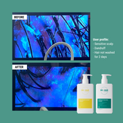Anti-Dandruff & Hair Loss Kit
