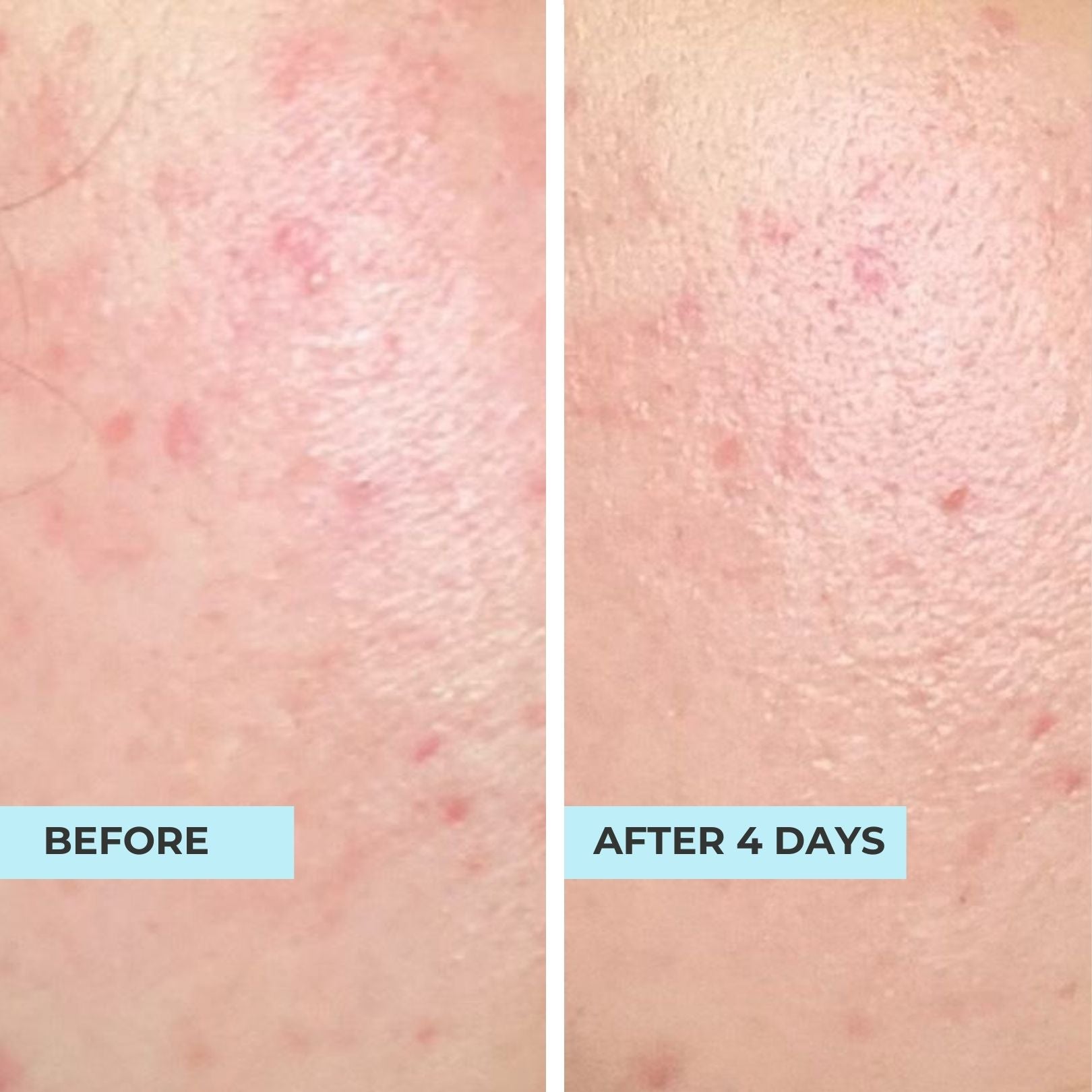 Dry Skin Rescue Kit