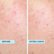 Dry Skin Rescue Kit