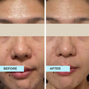 Dry Skin Rescue Kit