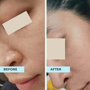 Dry Skin Rescue Kit