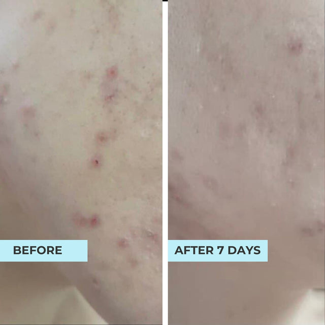 Customer result photo