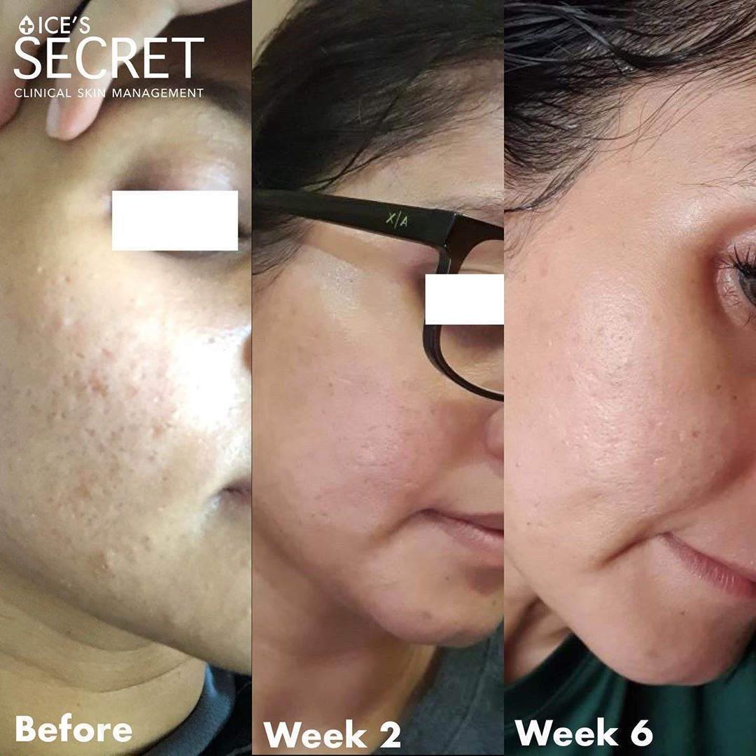 Everyday Moisturising Protective Spray (Sunscreen)