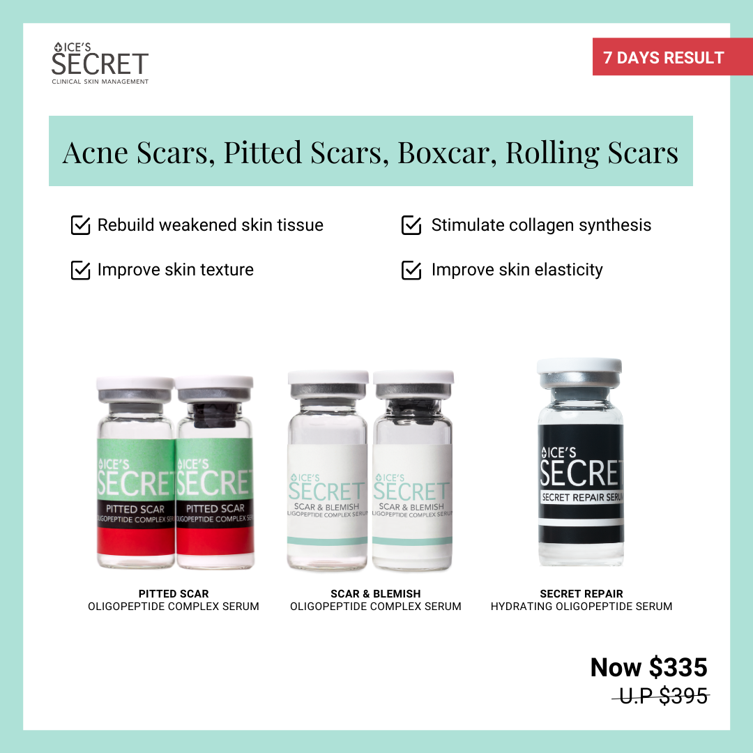 Acne Scars, Pitted Scars, Boxcar Scars, Rolling Scars Kit