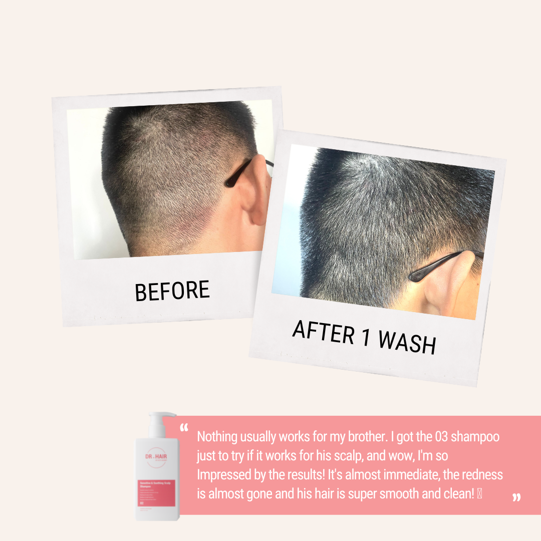Strengthen Scalp & Soothe Sensitivity Kit