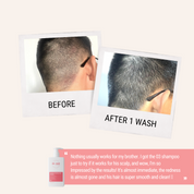 Strengthen Scalp & Soothe Sensitivity Kit